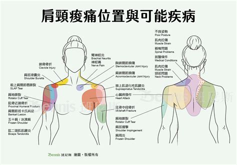 氣節不順|「氣結」易造成肩頸痠痛、胸悶 練習正念氣功有助改。